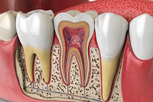 The root canal treatment process is safe, effective, and pain free