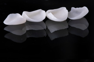 Close-up of four veneers in a row